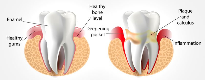 Dental Care in Vellore